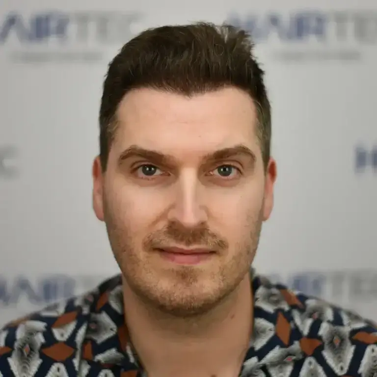 tom dice before and after foto resultaat