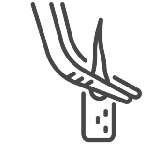 Direct implantation of the hair follicles